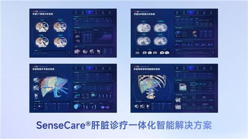 商湯醫(yī)療獲肝臟CT輔助診斷NMPA三類證，軟硬件零售賦能肝臟診療一體化新格局